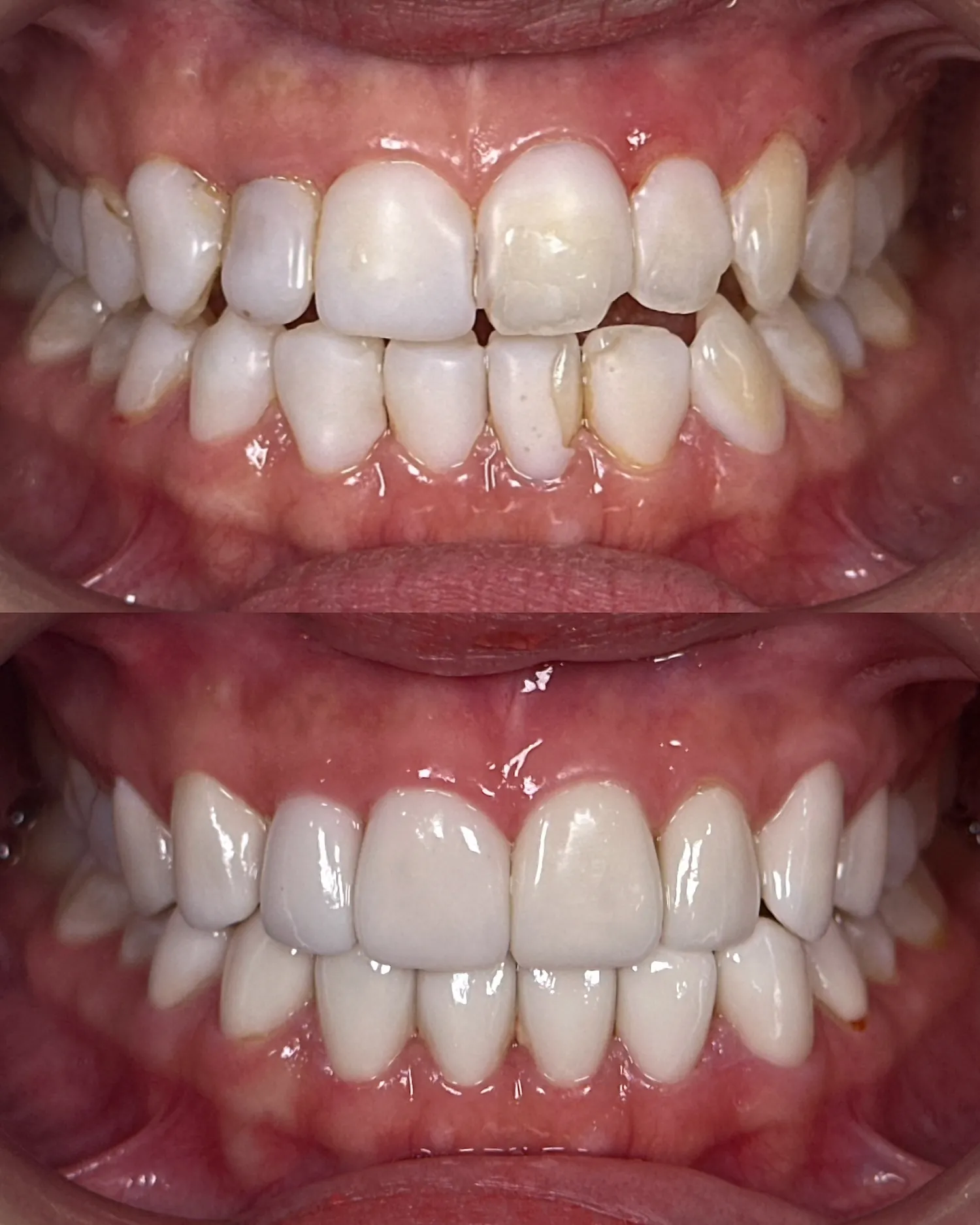 A Smile You're Proud of