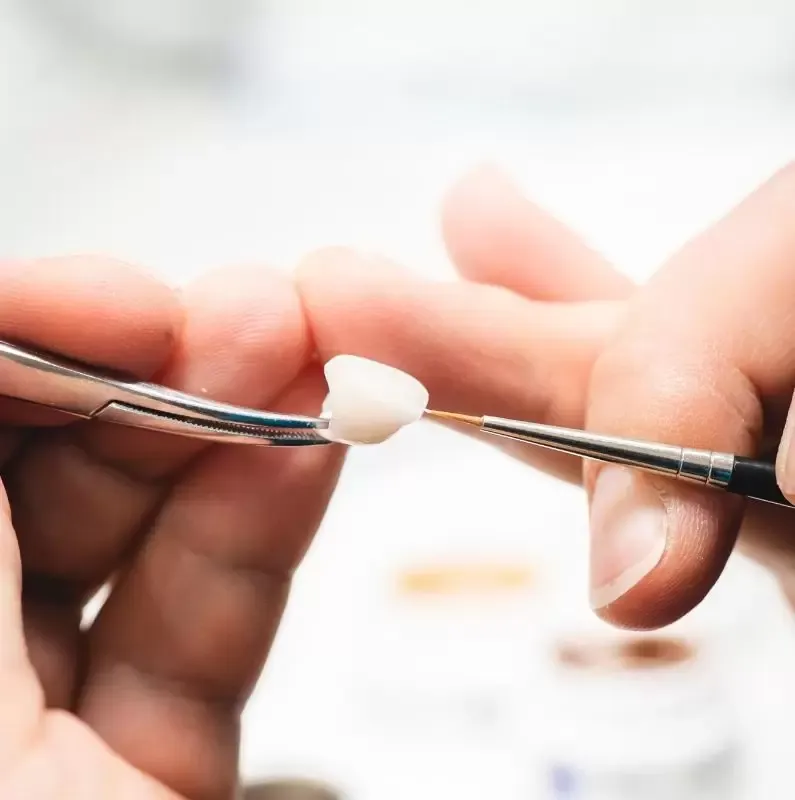 Braces (Orthodontics)